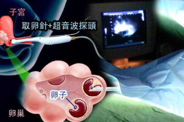 武汉试管婴儿成功率高的医院除了武汉同济还有哪些